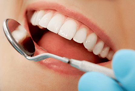 dental exams